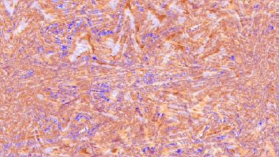 antigens and granulocytes
