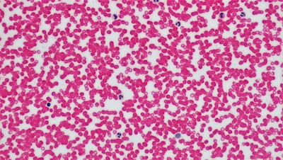 Immunological Memory 